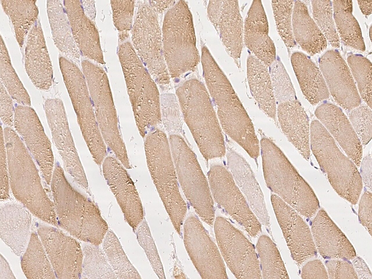 AGTPBP1 Antibody - BSA Free