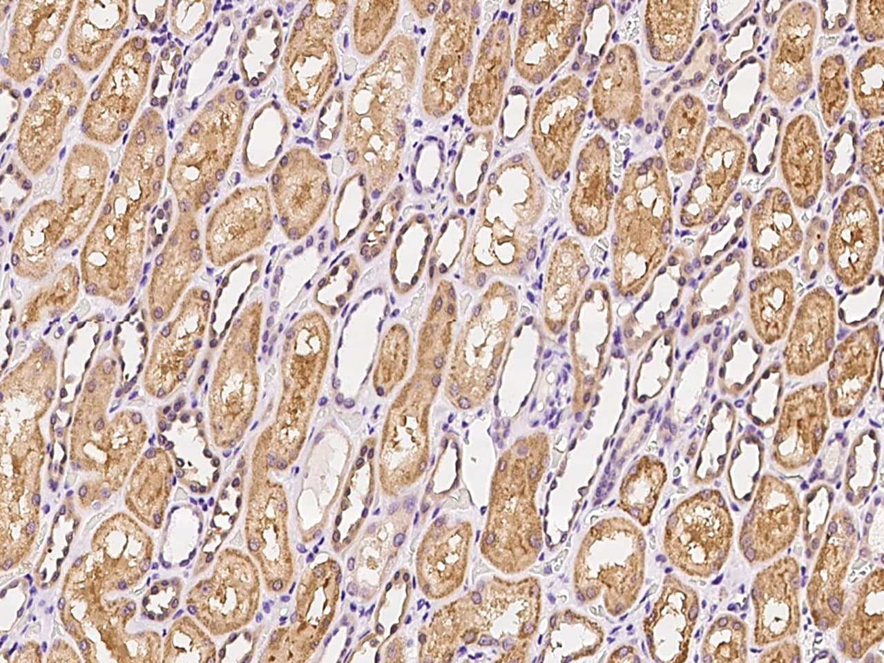 ATP12A Antibody - BSA Free