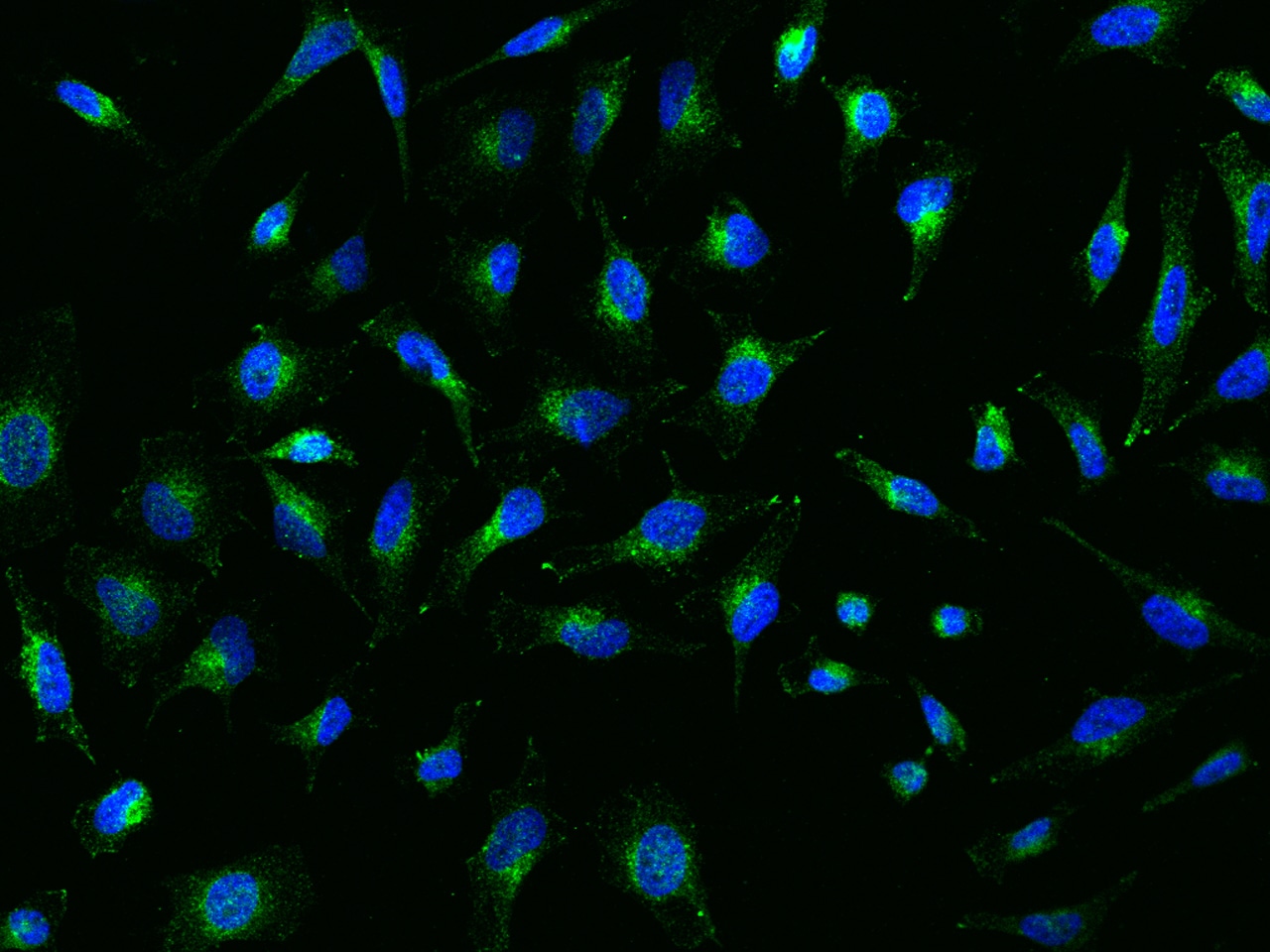 SPPL2a Antibody - BSA Free