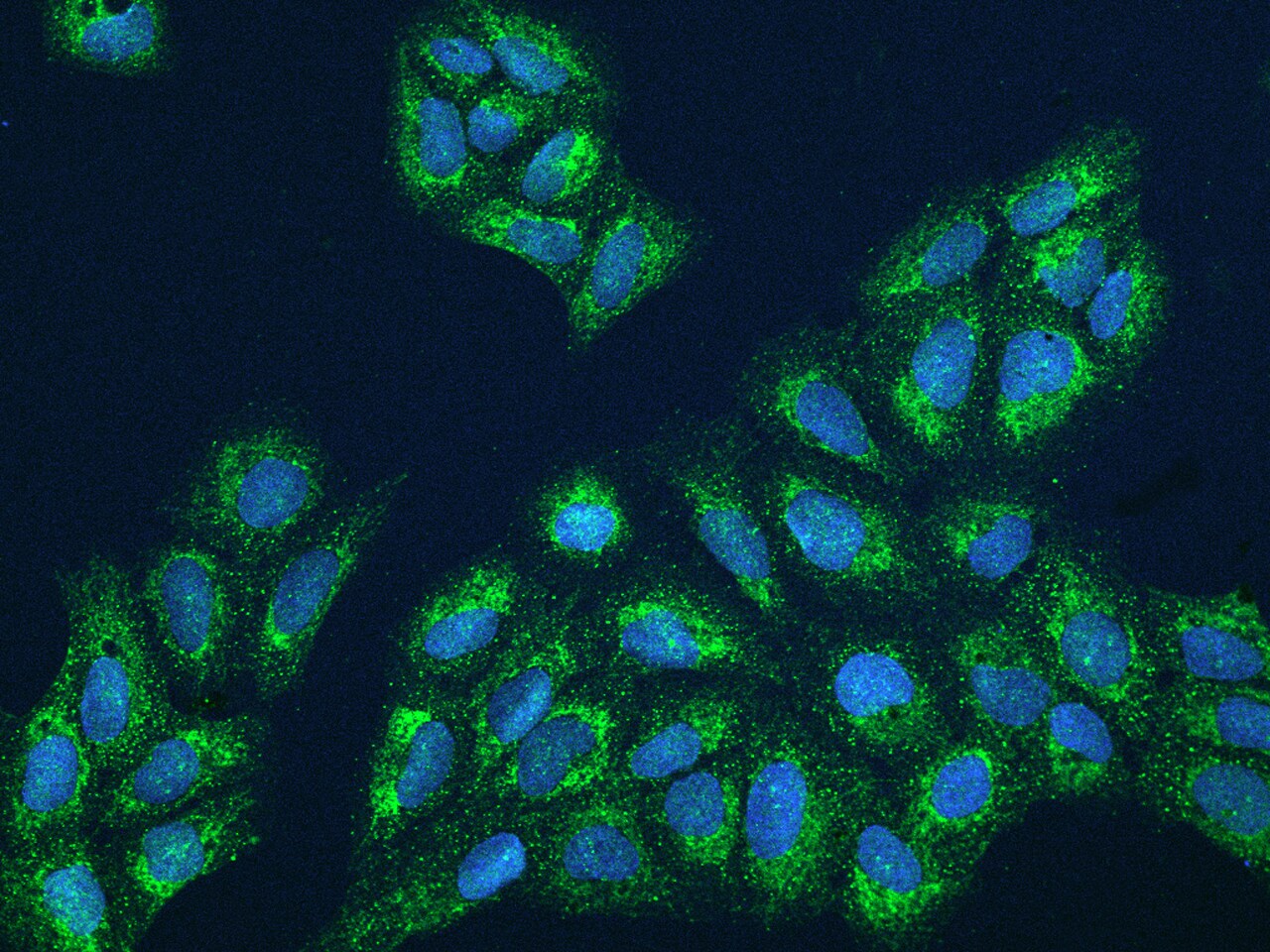 FbxL12 Antibody - BSA Free
