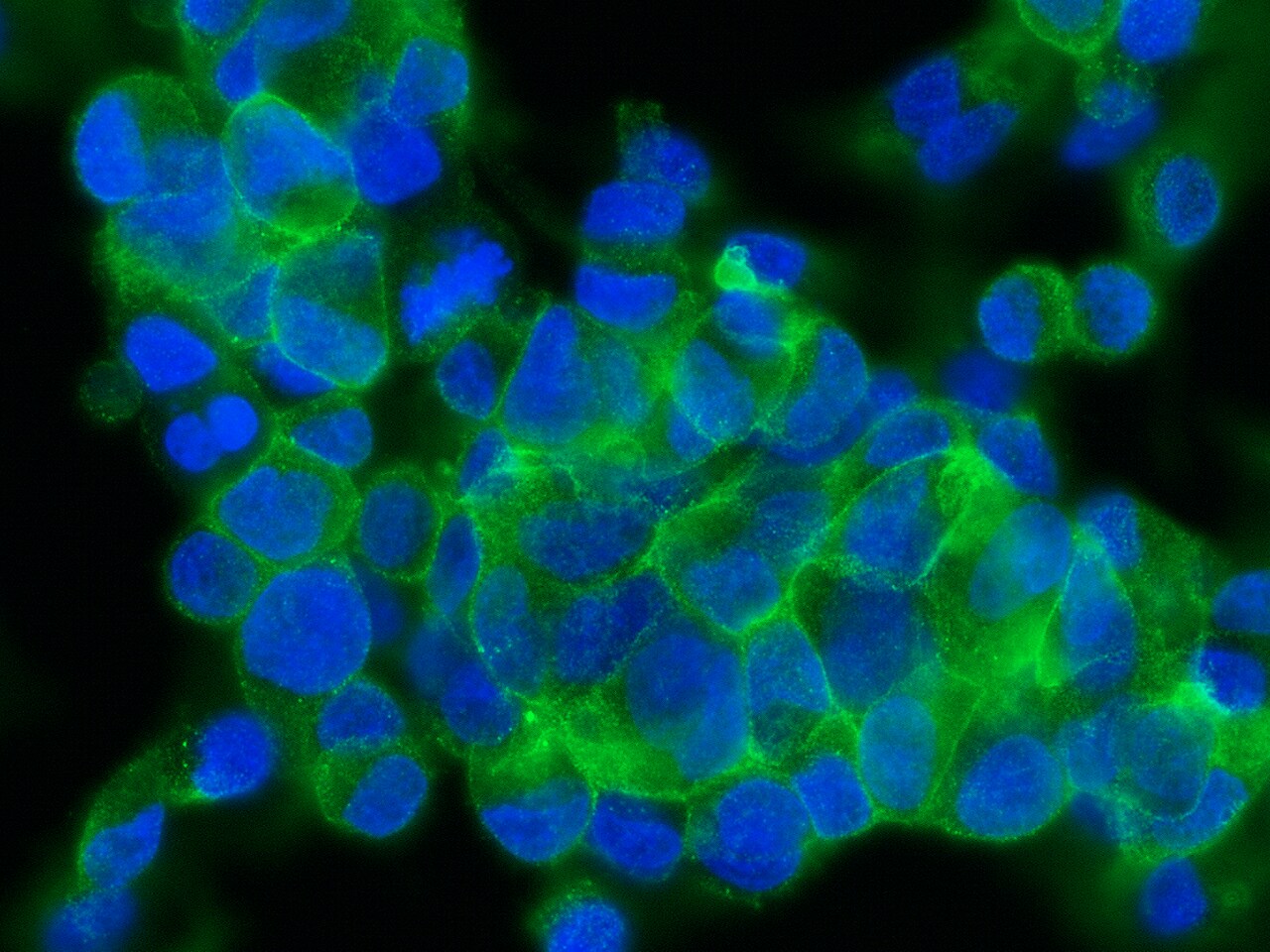 Asialoglycoprotein Receptor 2 Antibody (002) - Azide and BSA Free