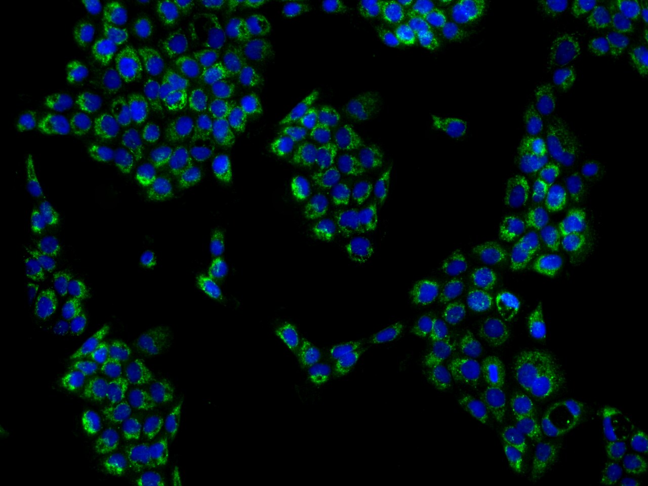 KHDC1 Antibody - BSA Free