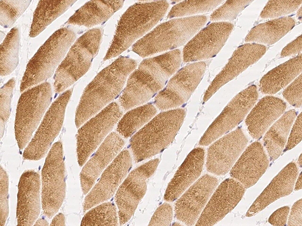 GHITM Antibody - BSA Free
