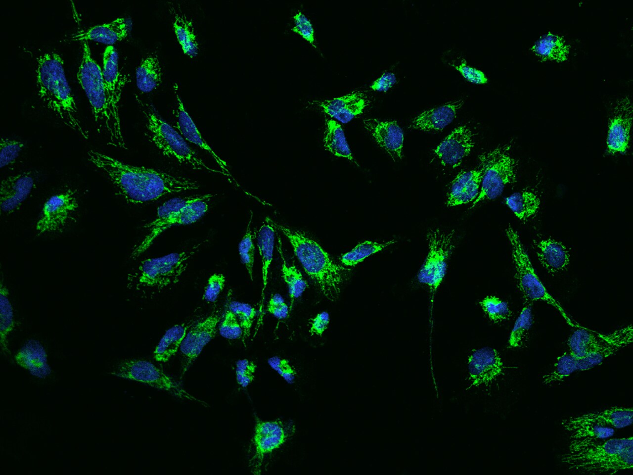 CLPP Antibody - BSA Free