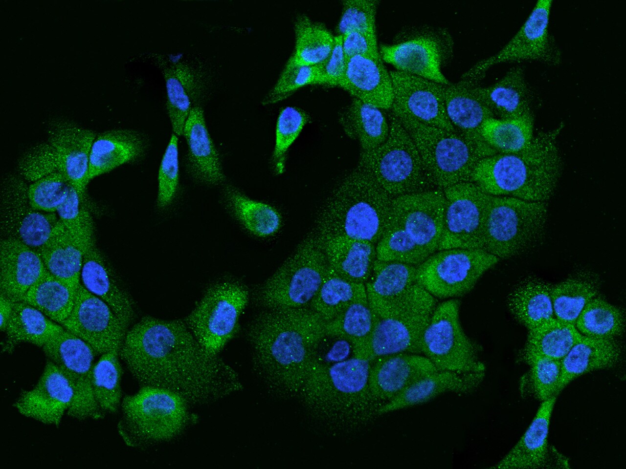 MADD Antibody - BSA Free