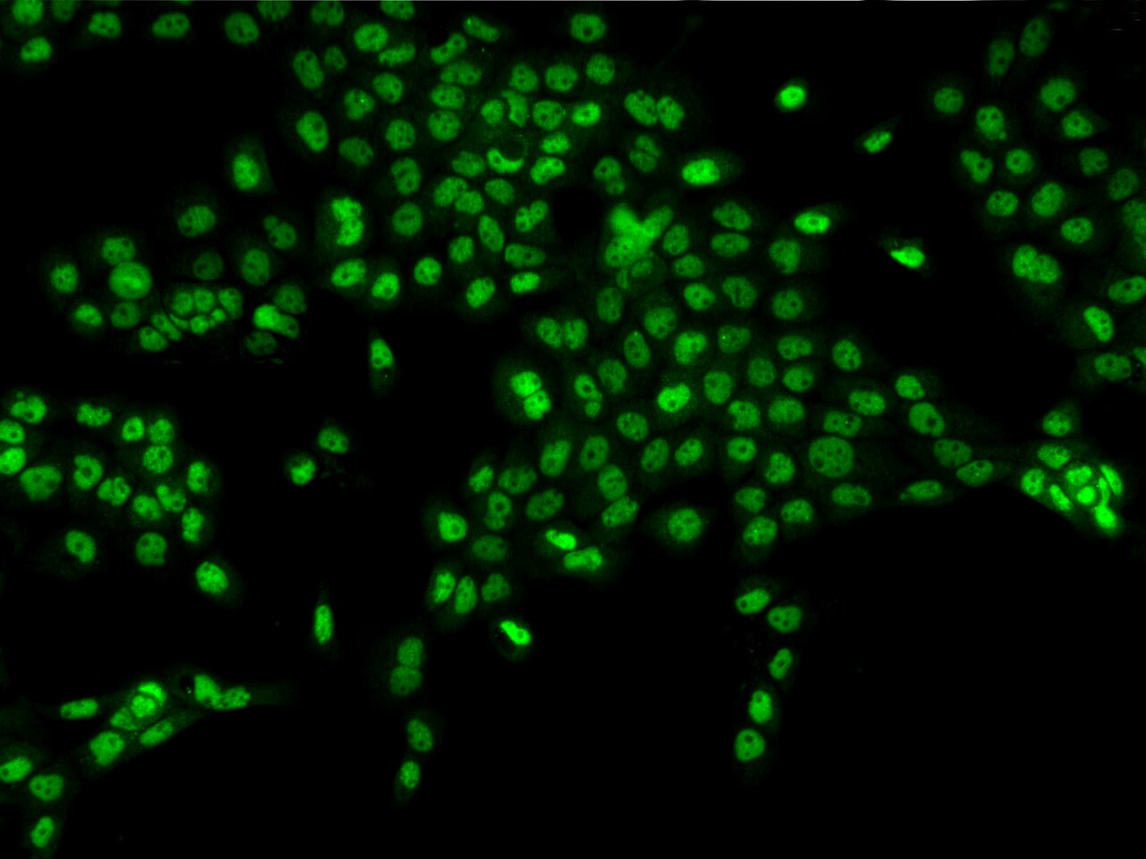 MORC3 Antibody - BSA Free