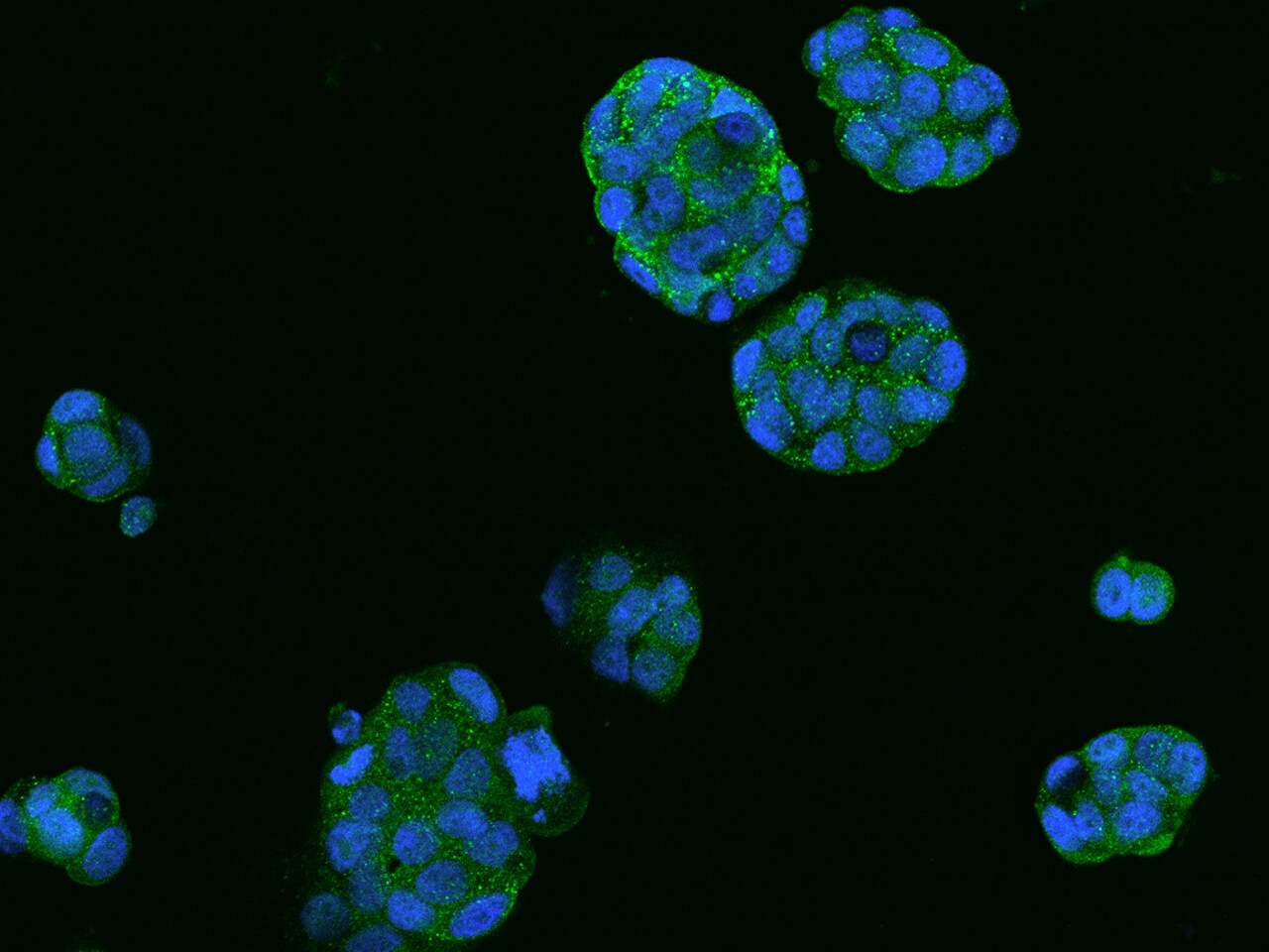 SNAP25 Interacting Protein Antibody - BSA Free