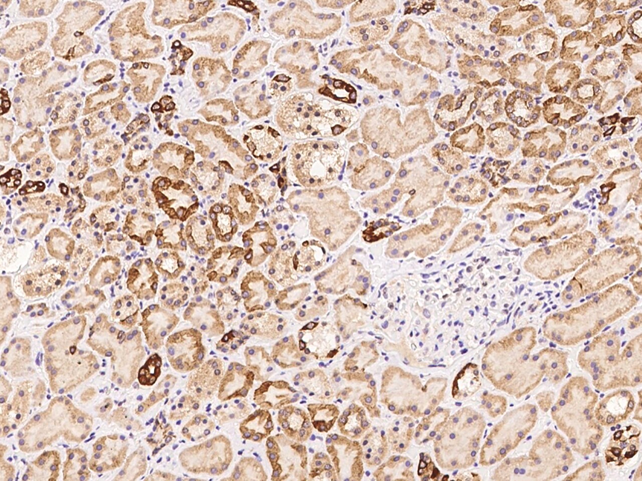 ELYS Antibody - BSA Free