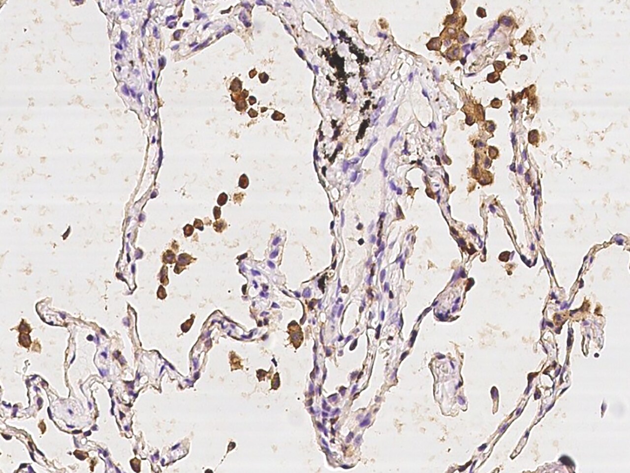 Leupaxin Antibody - BSA Free