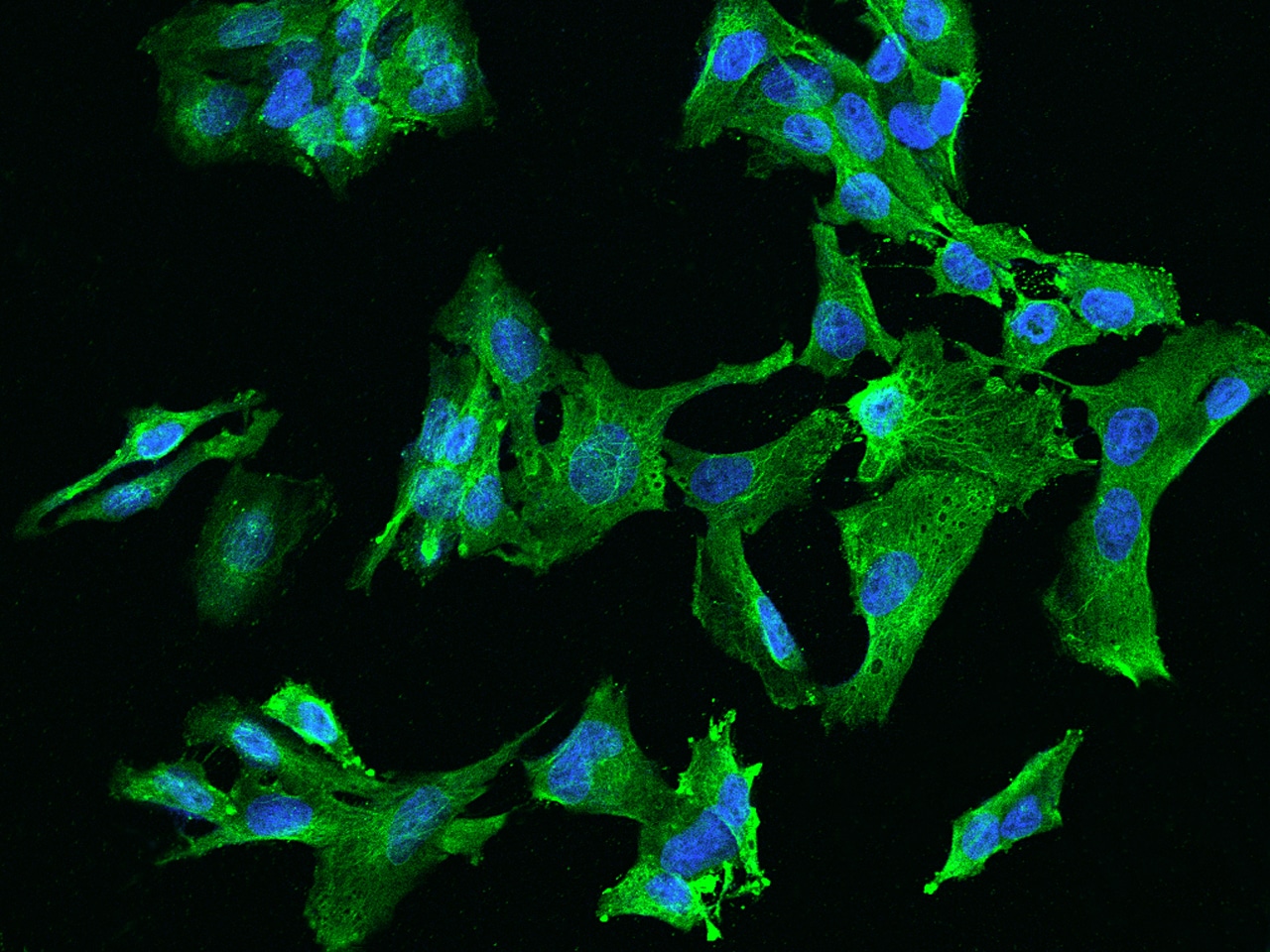 CCDC40 Antibody - BSA Free