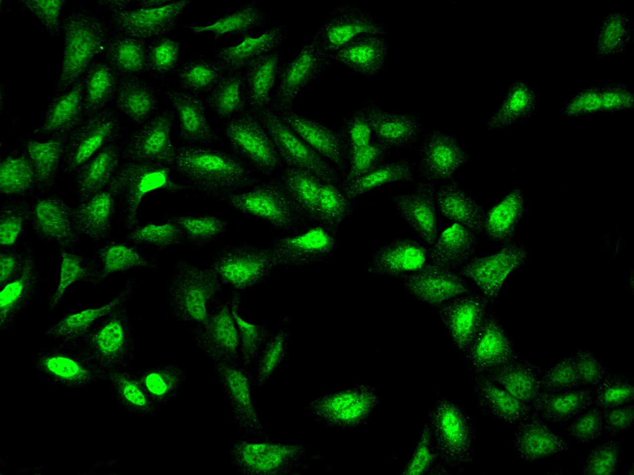 ZNF462 Antibody - BSA Free