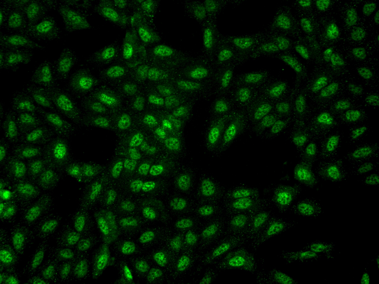 STPG4 Antibody - BSA Free