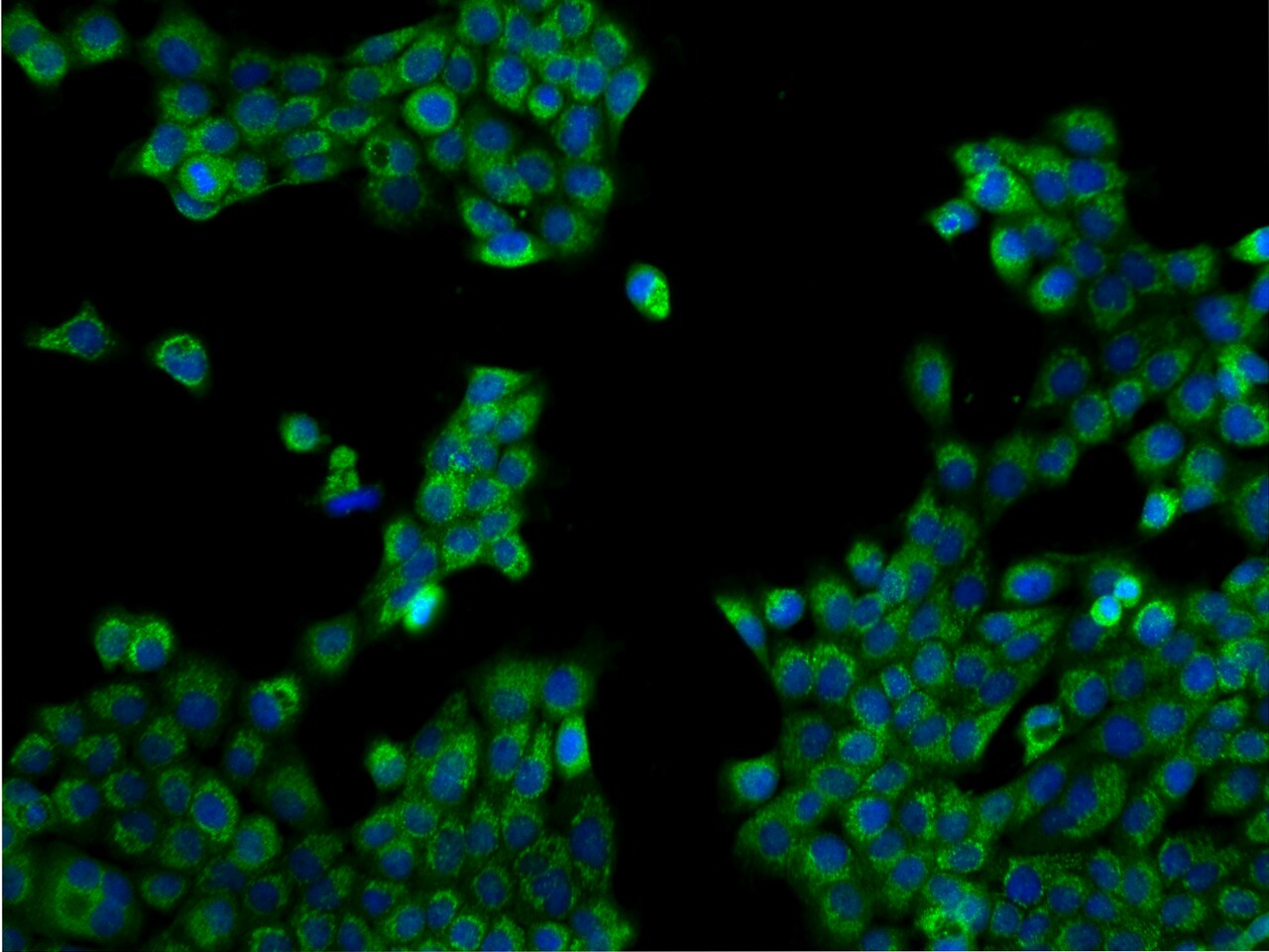 TEX9 Antibody - BSA Free