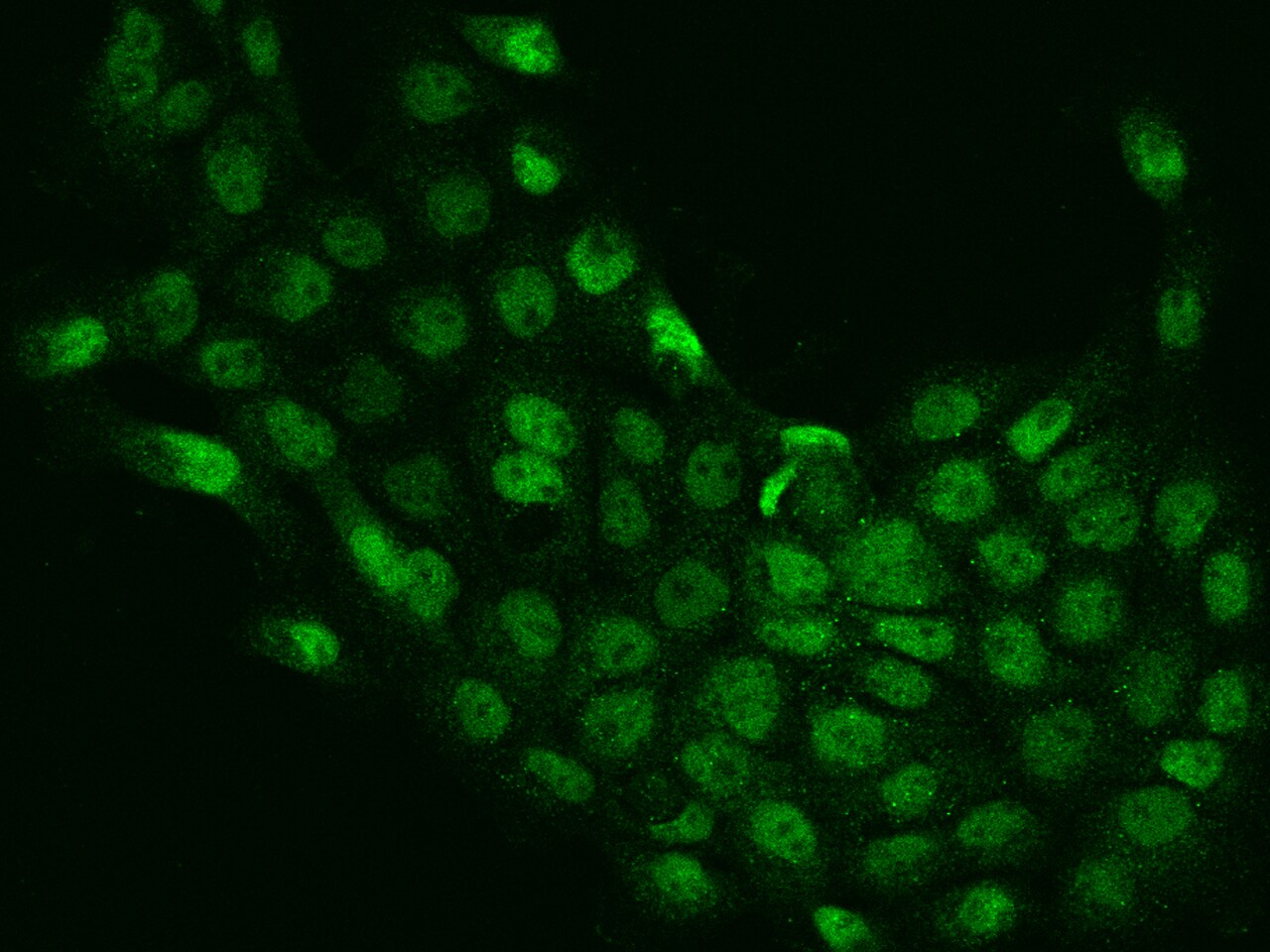 MBTD1 Antibody - BSA Free