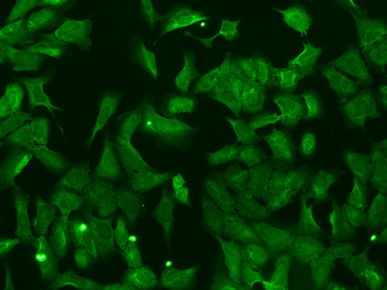 NUDT11 Antibody - BSA Free