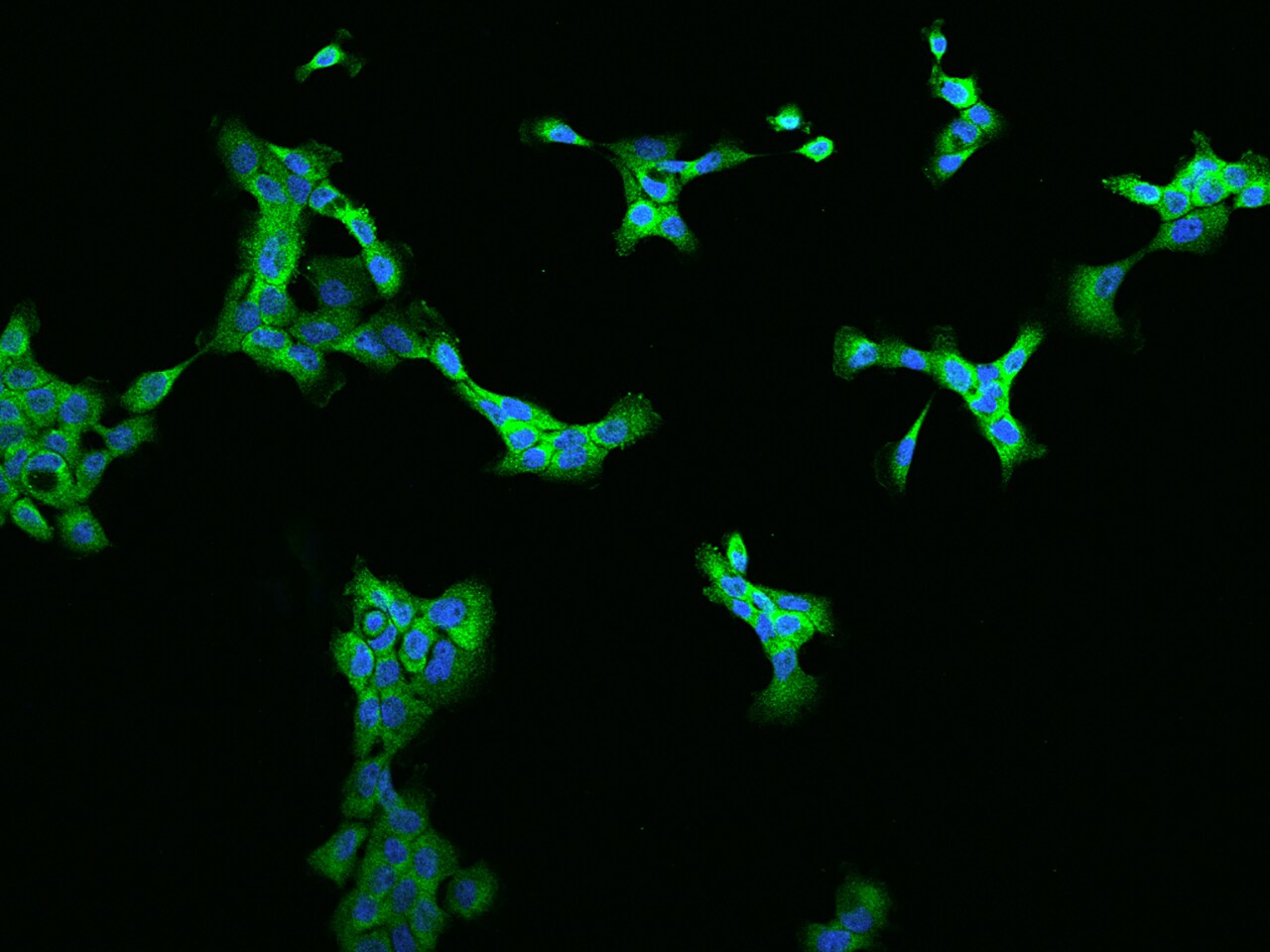 ZC3H7A Antibody - BSA Free