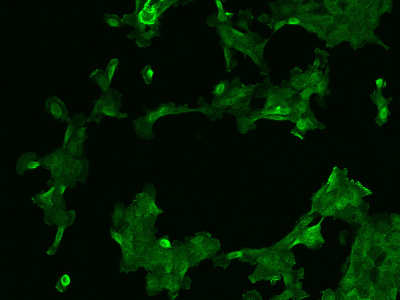 AFAP1L2 Antibody - BSA Free