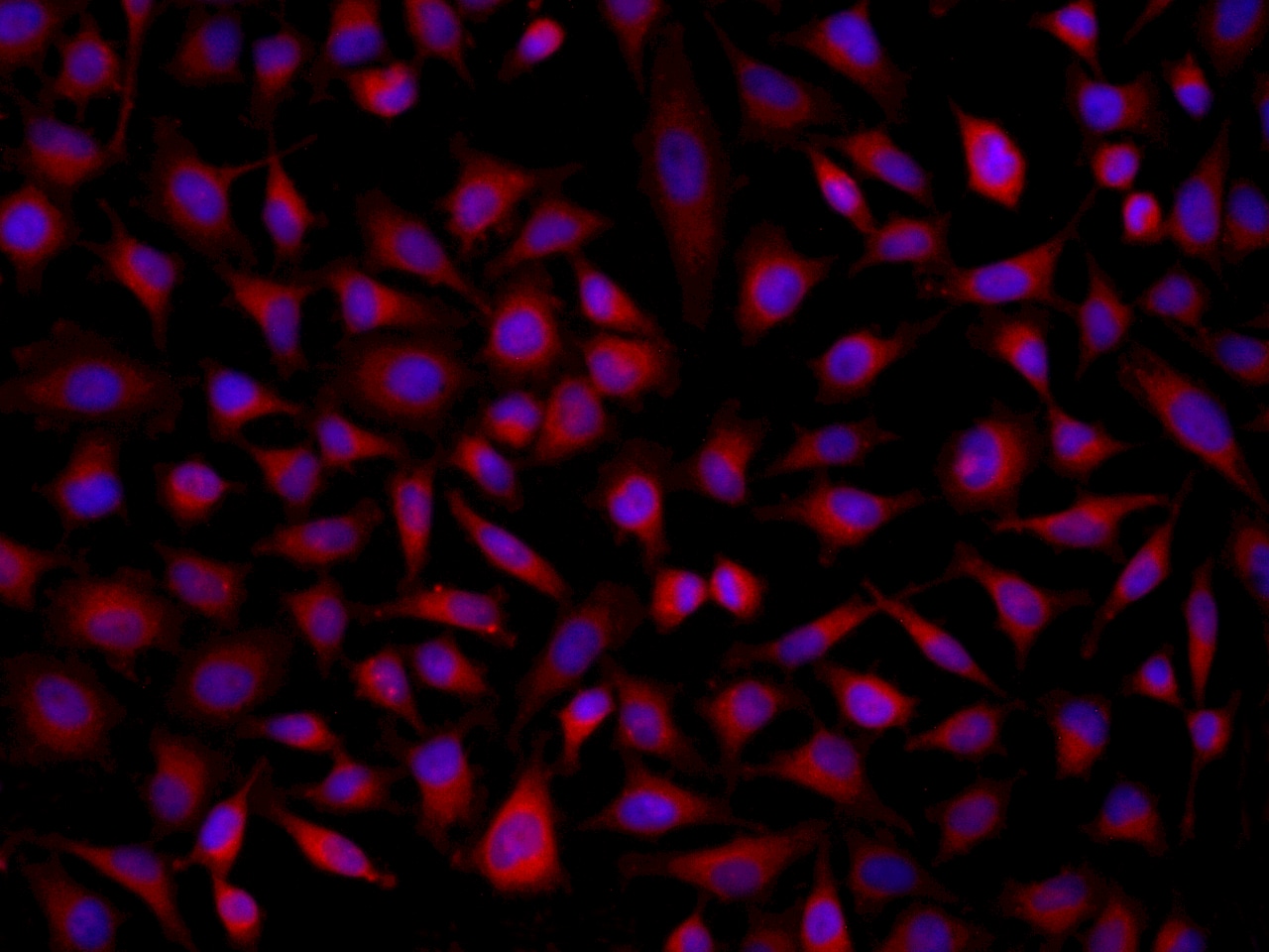 SOAT 2 Antibody - BSA Free