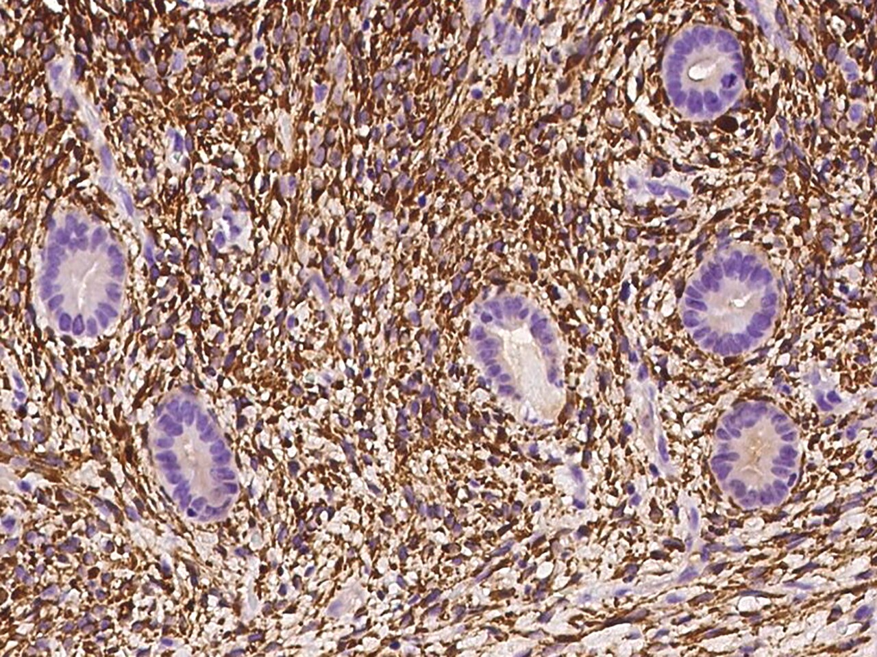 ALDH1A2 Antibody - BSA Free
