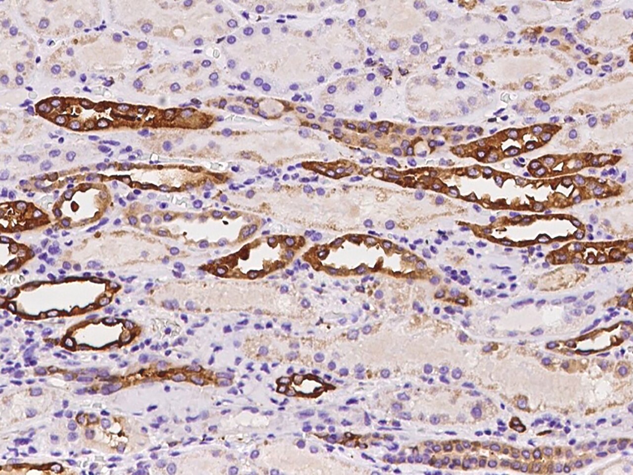 ALDH1A2 Antibody - BSA Free