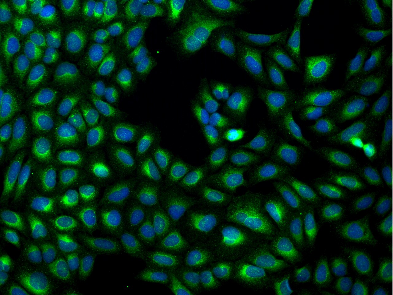 MXRA7 Antibody - BSA Free