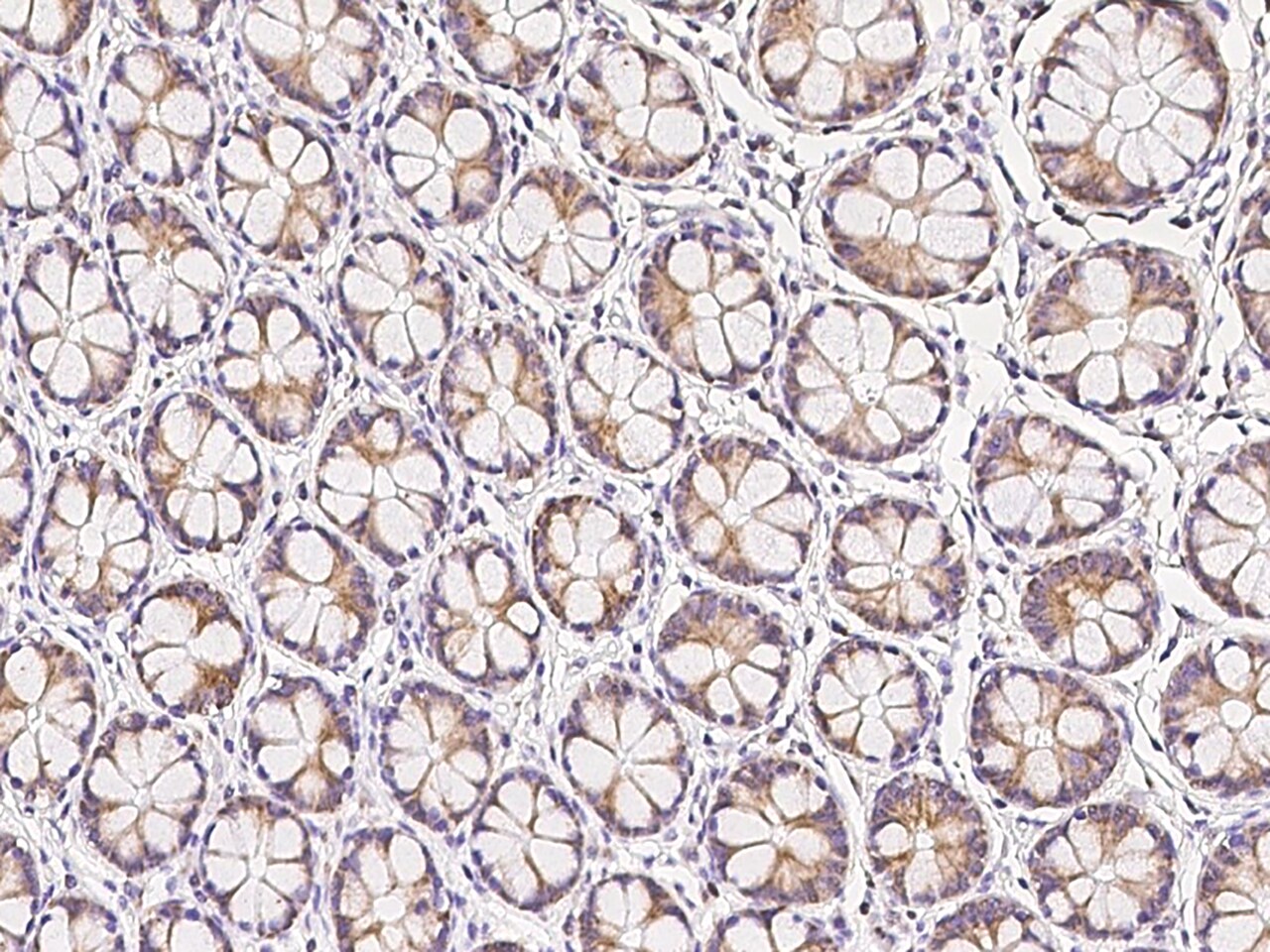 MRPL23 Antibody - BSA Free