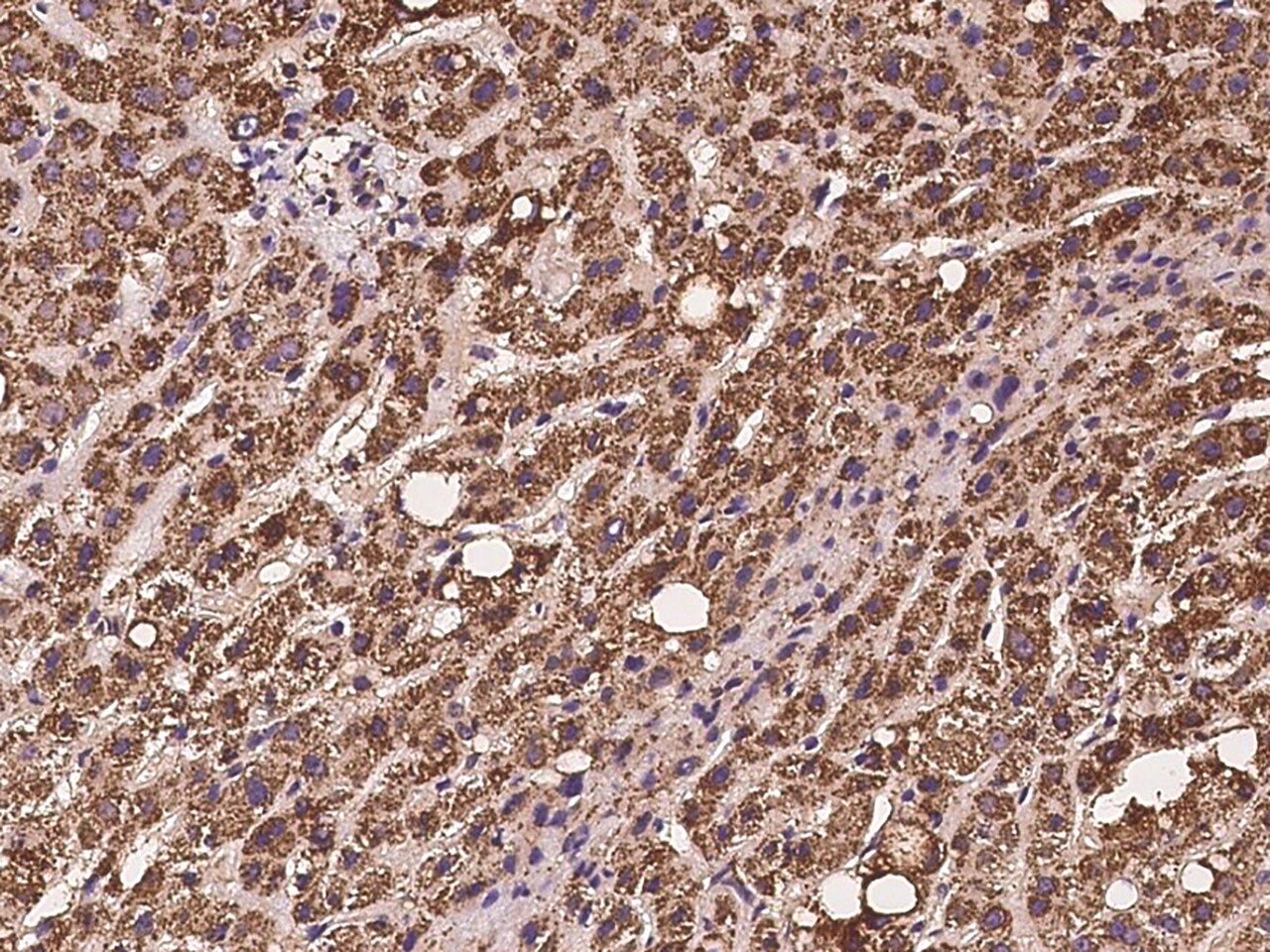 ACAA2 Antibody - BSA Free