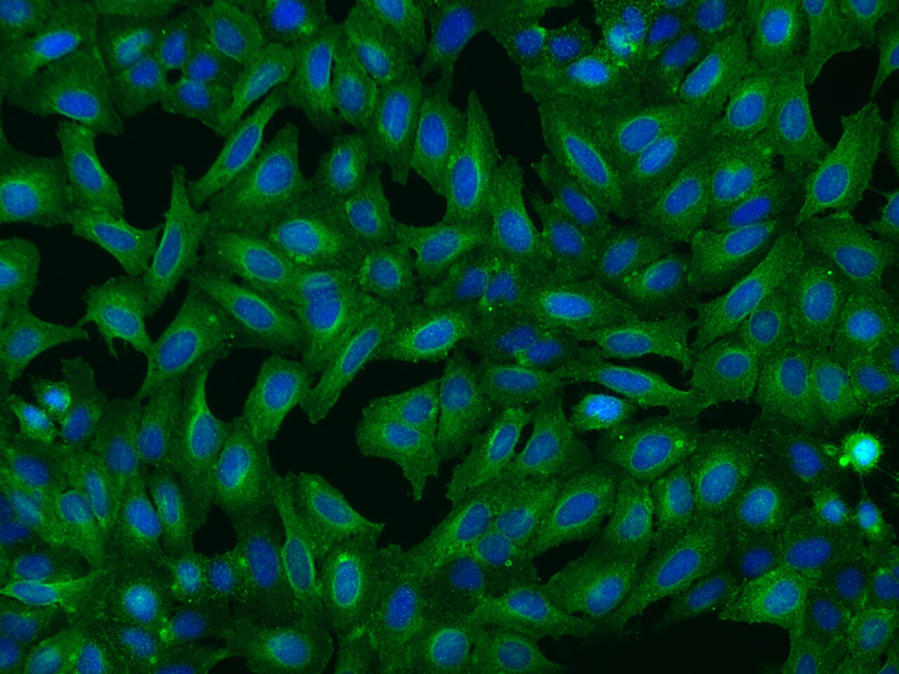 CCDC5 Antibody - BSA Free
