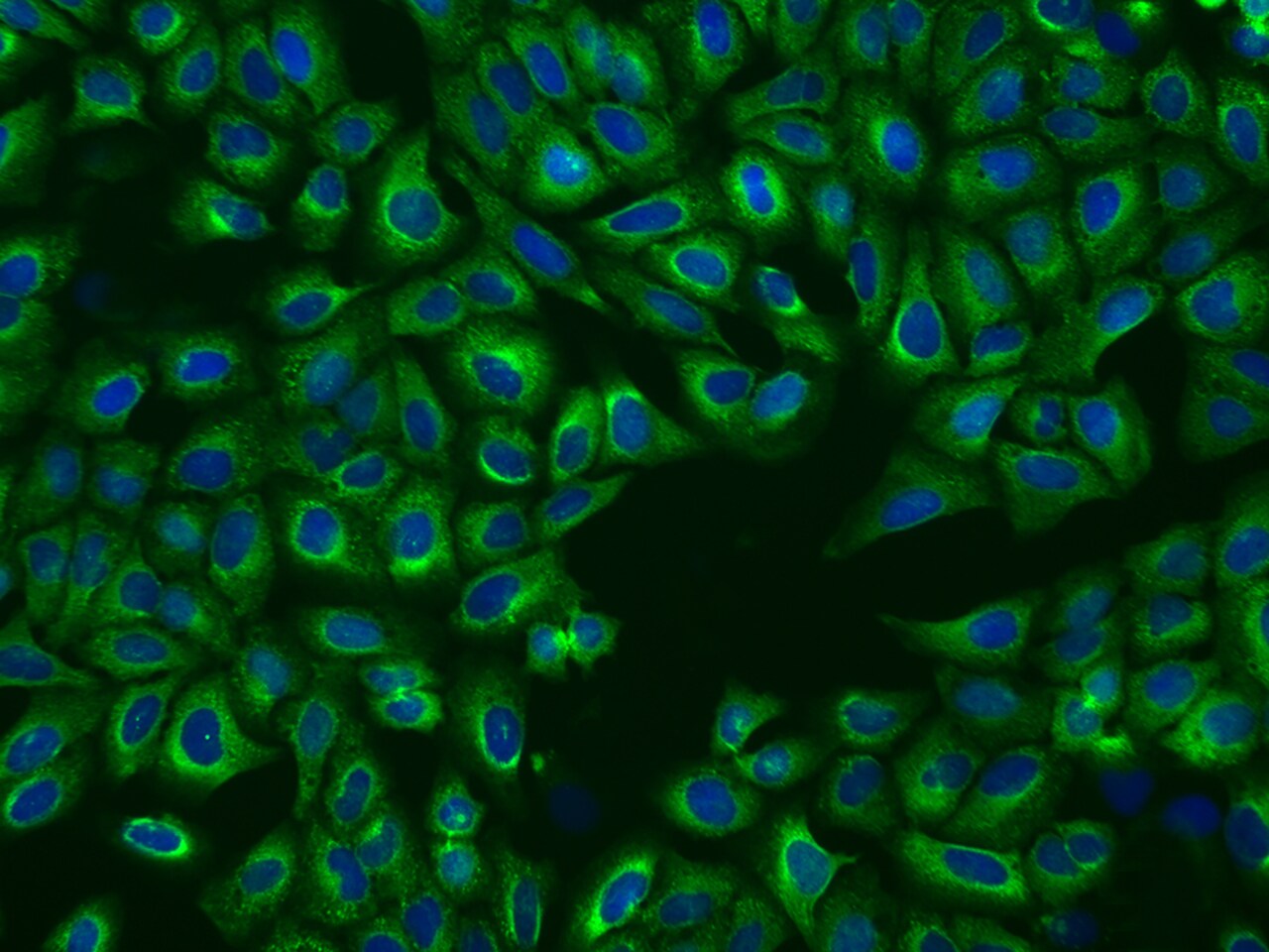 P4HA2 Antibody - BSA Free