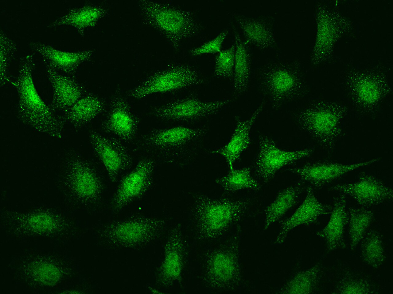 CaMKV Antibody - BSA Free