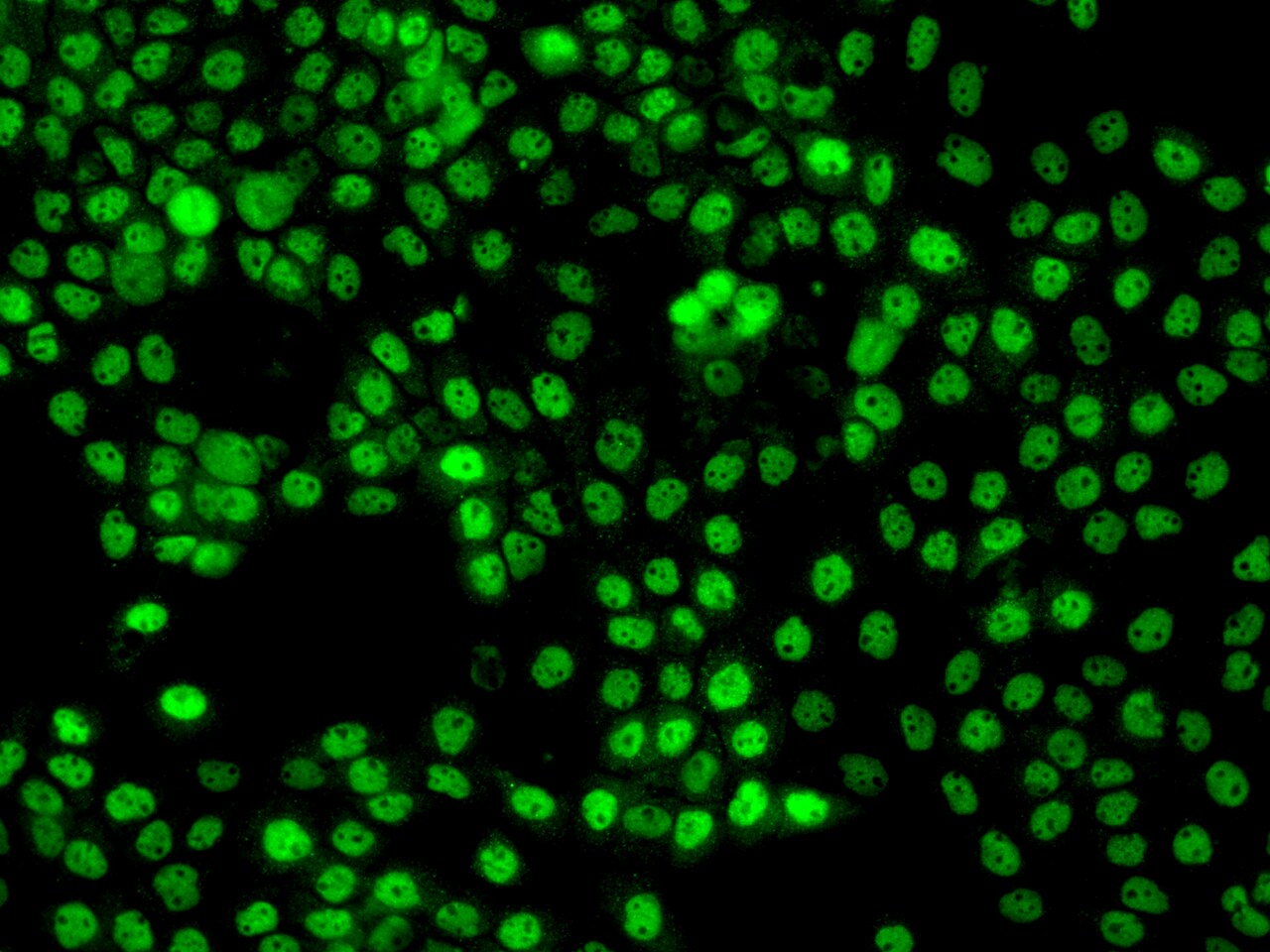 ZNF205 Antibody - BSA Free