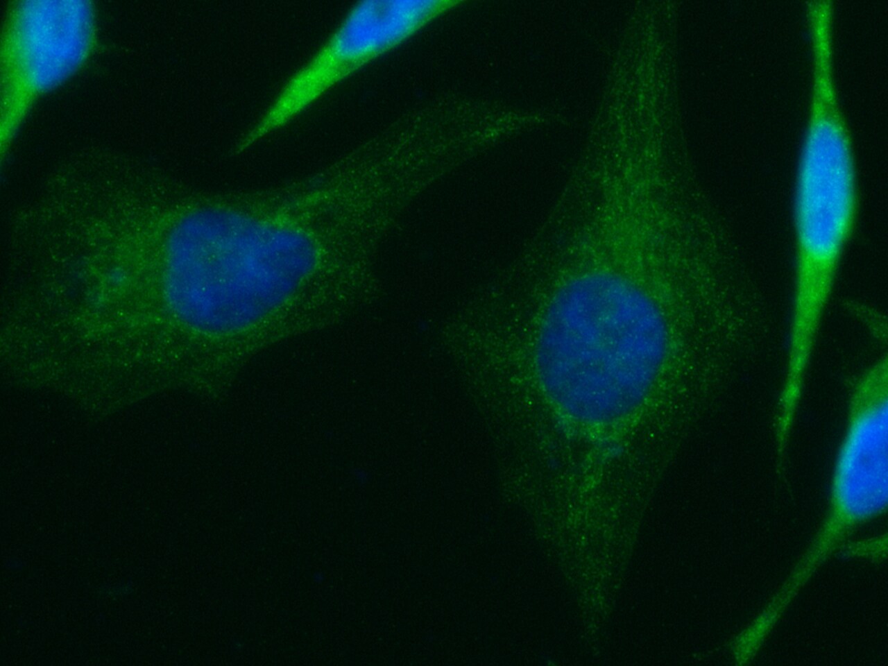 IVD Antibody (04) - Azide and BSA Free
