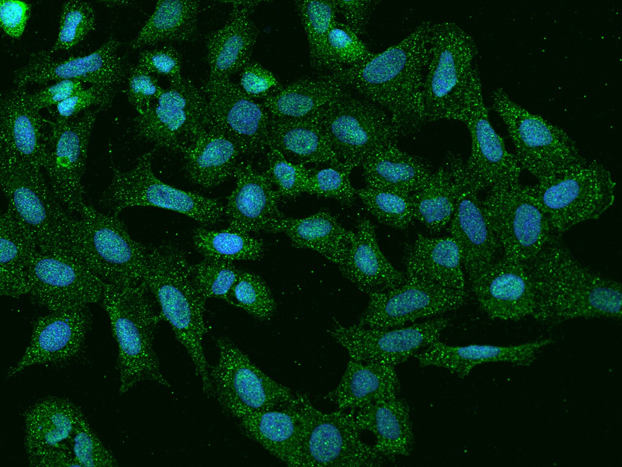 PLEKHH2 Antibody - BSA Free