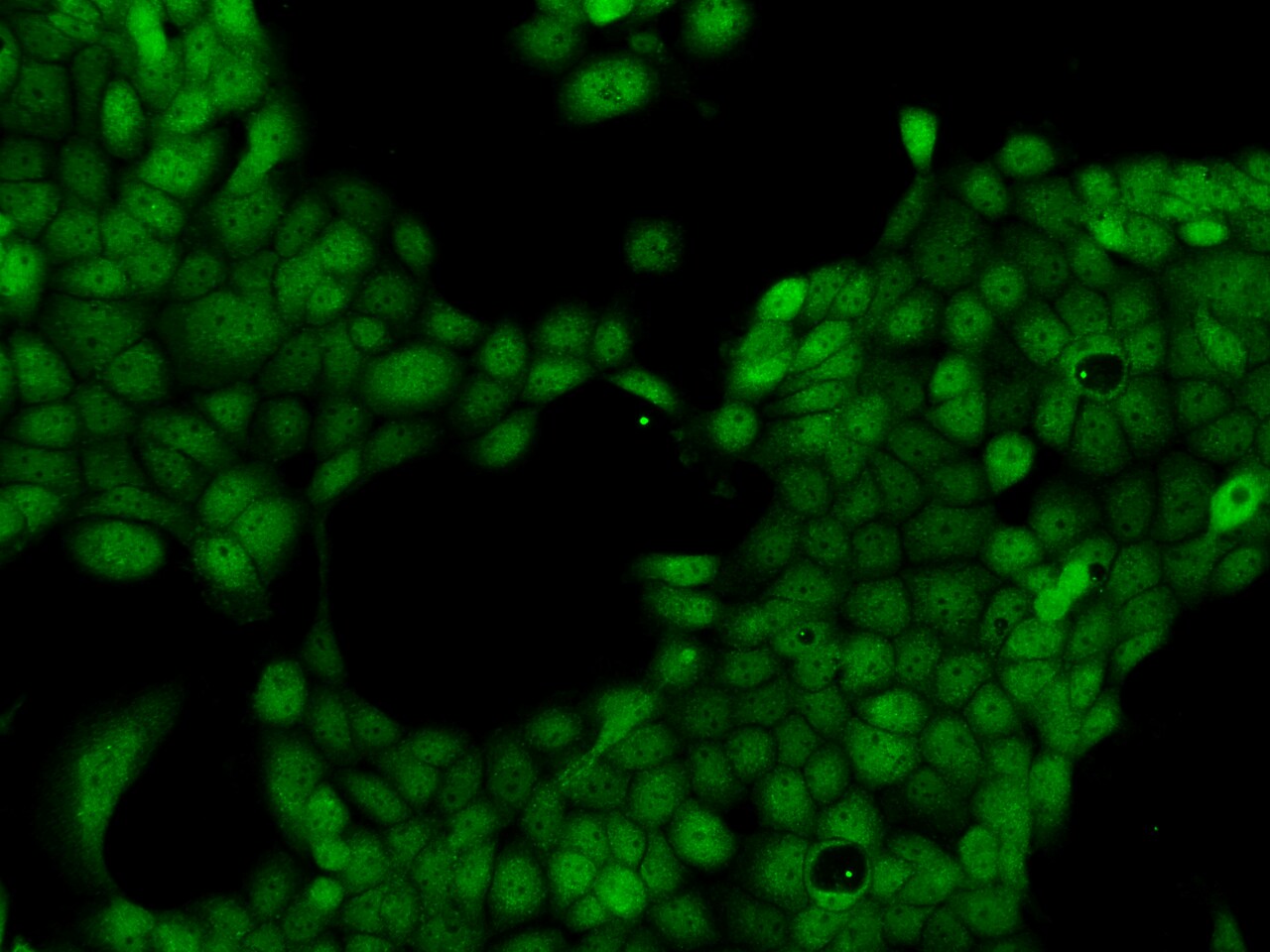 LMBRD2 Antibody - BSA Free