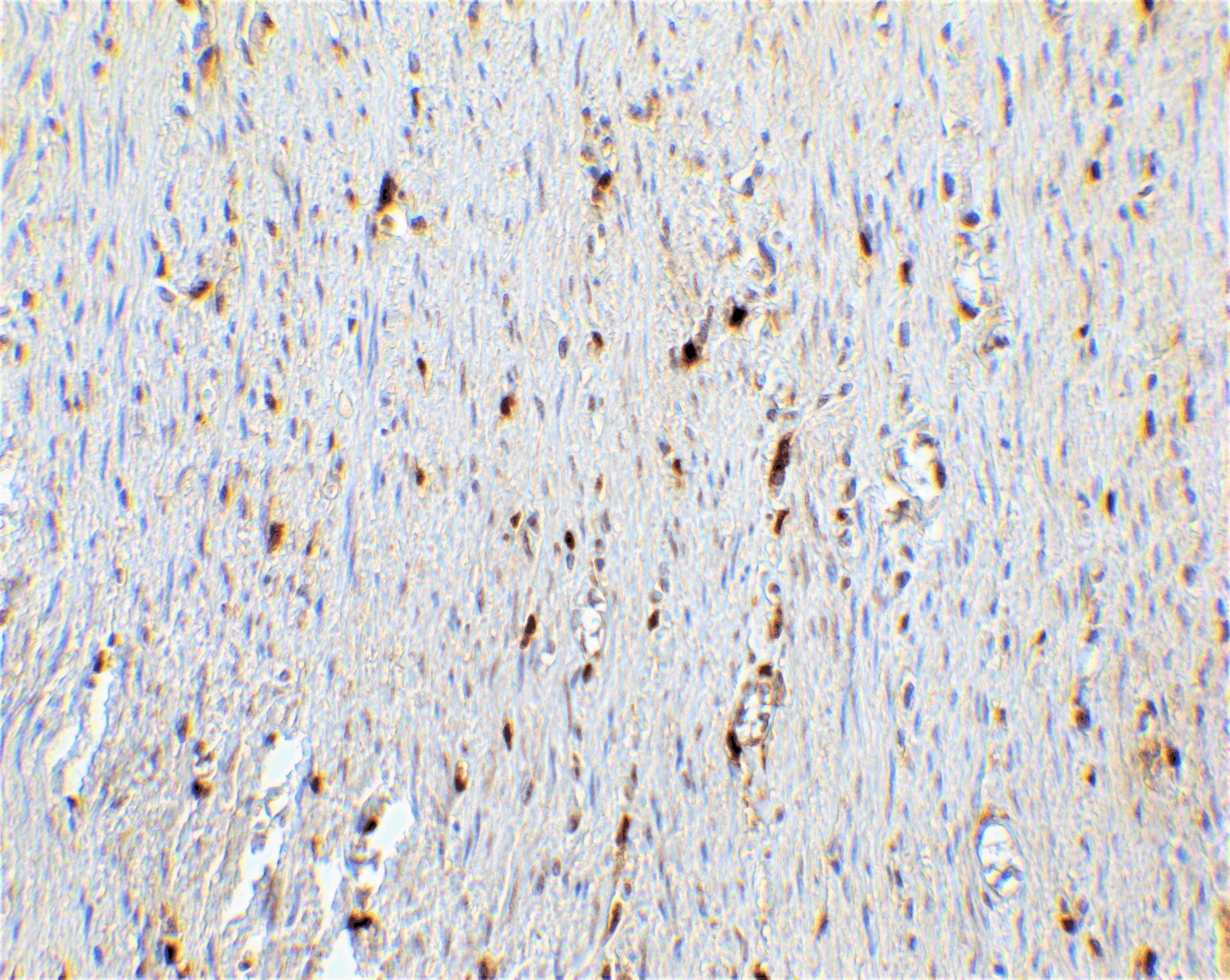 p16INK4a/CDKN2A Antibody - BSA Free