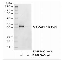 SARS-CoV-2 Nucleocapsid Antibody (84C4a)