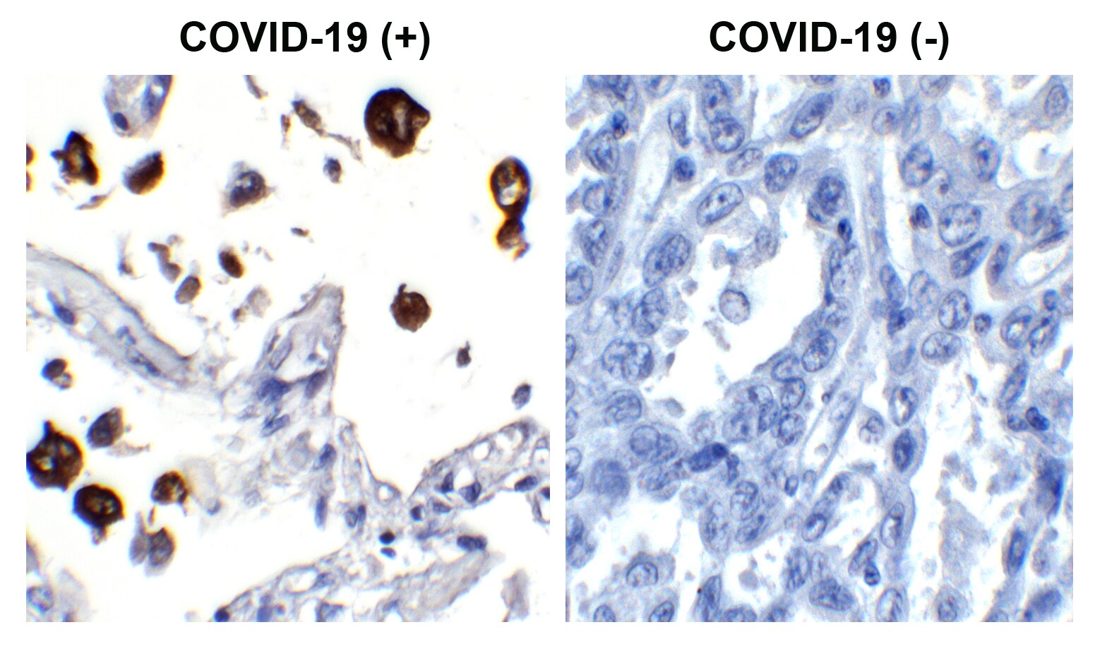 SARS-CoV-2 Nucleocapsid Antibody (84C4a)