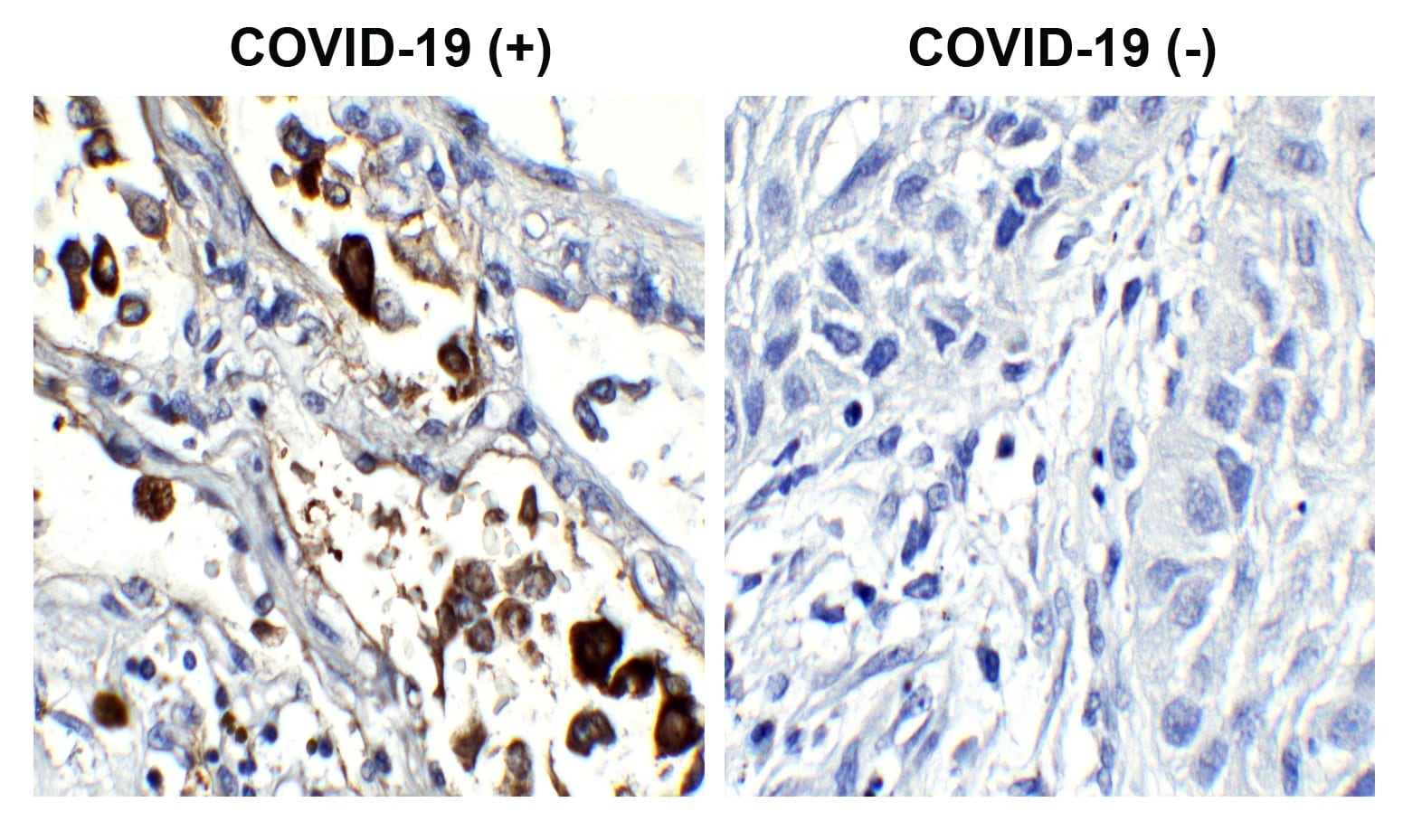 SARS-CoV-2 Nucleocapsid Antibody (84D7)