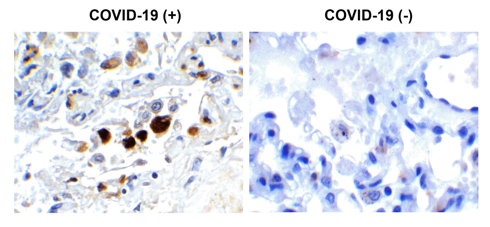 SARS-CoV-2 Membrane Protein Antibody - BSA Free