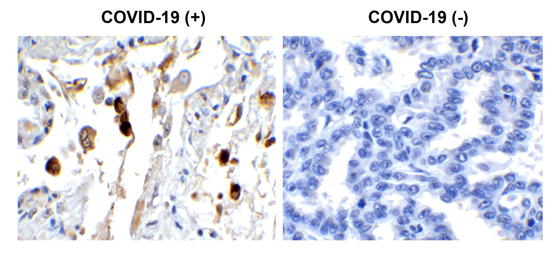 SARS-CoV-2 Membrane Protein Antibody - BSA Free