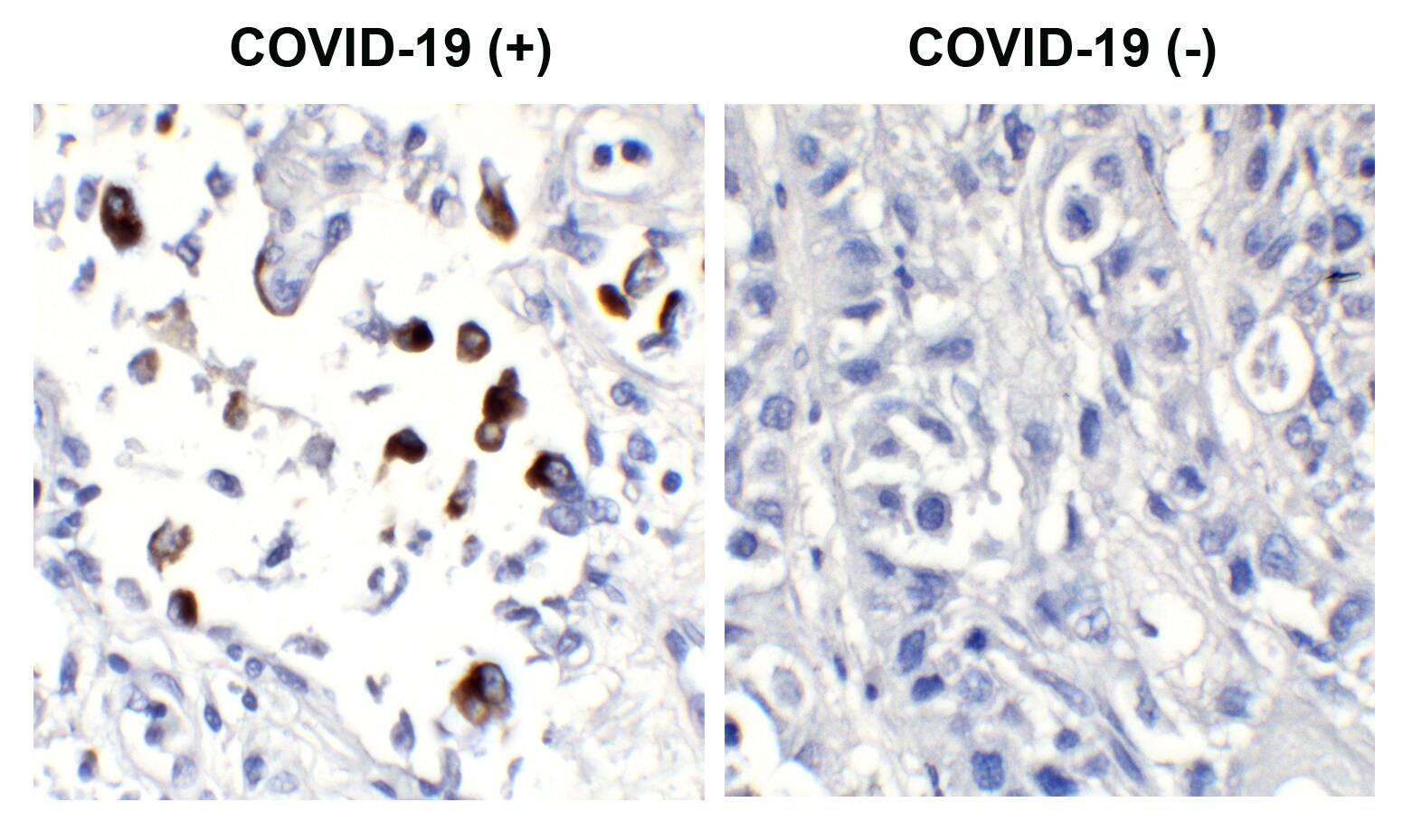 SARS-CoV-2 Spike S1 Antibody (SP185) - Azide and BSA Free