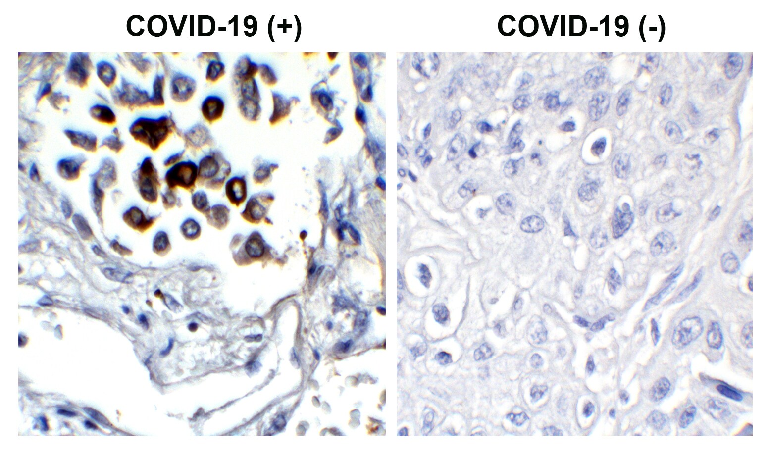 SARS-CoV-2 Nucleocapsid Antibody (3865) - BSA Free