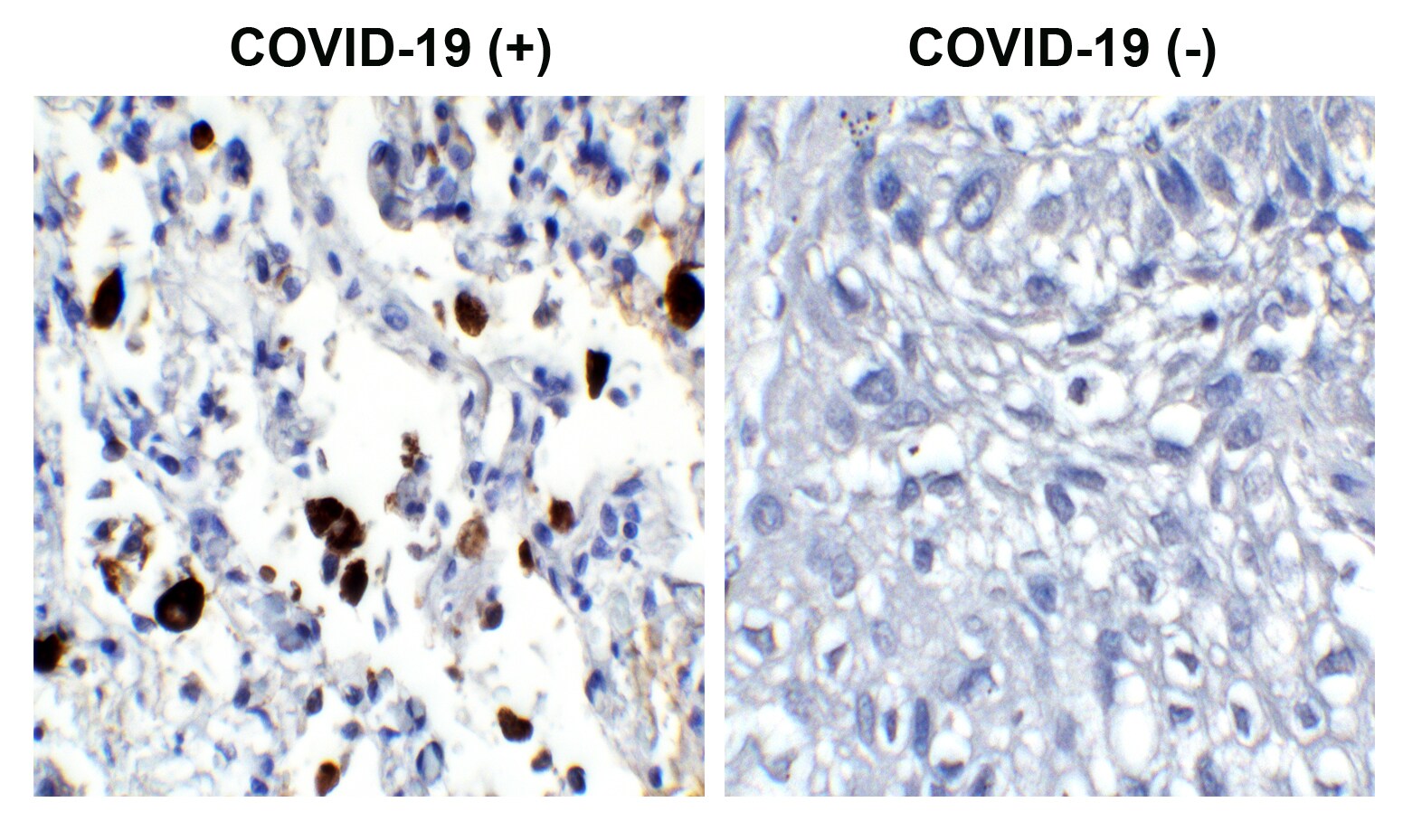 SARS-CoV-2 Nucleocapsid Antibody (3866) - BSA Free