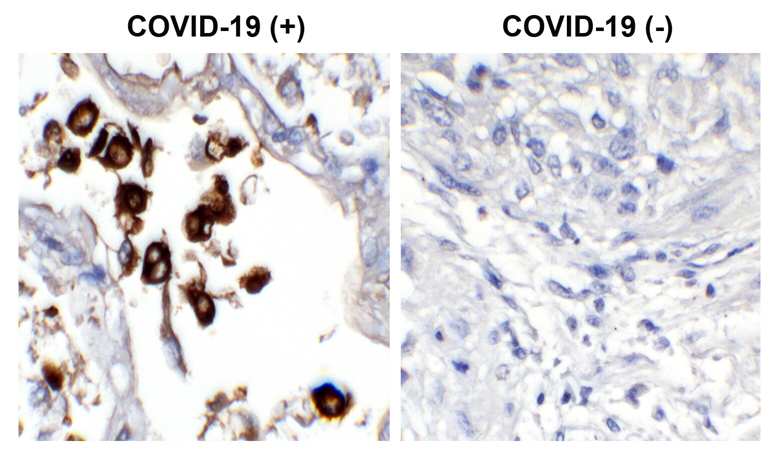 SARS-CoV-2 Nucleocapsid Antibody (NP1189) - Azide and BSA Free