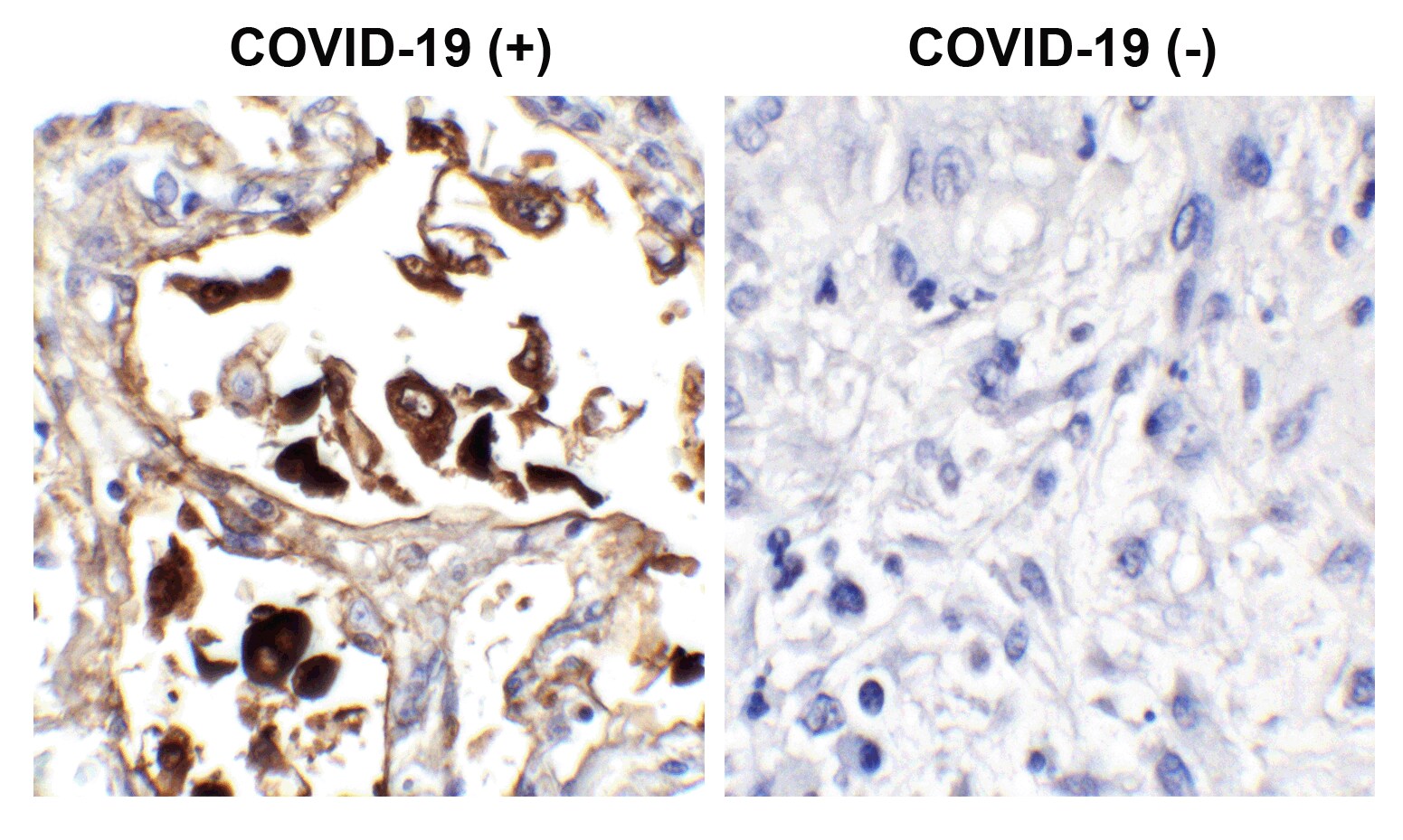 SARS-CoV-2 Nucleocapsid Antibody (NP642) - Azide and BSA Free