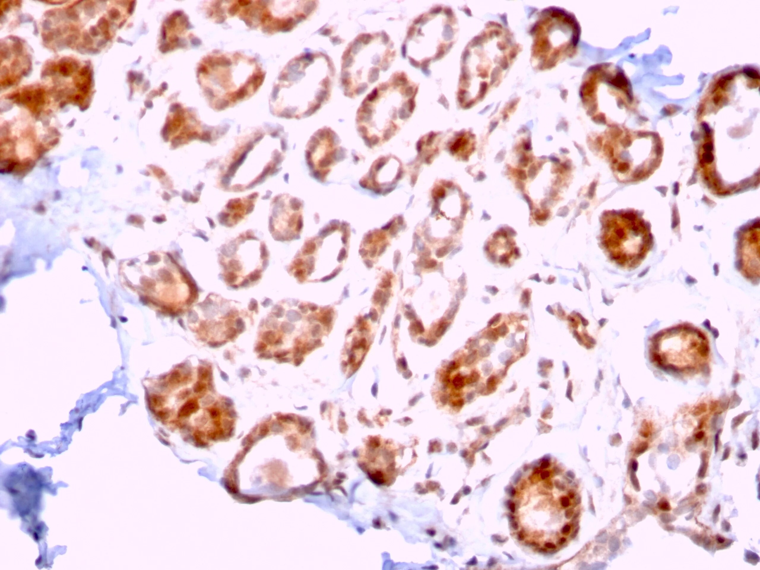 ERCC1 Antibody (ERCC1/2318) Immunohistochemistry-Paraffin: ERCC1 Antibody (ERCC1/2318) [NBP3-07161] -