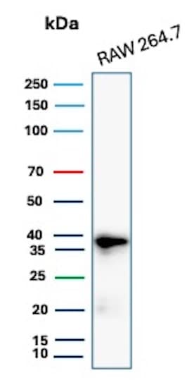 Cyclin D1 Antibody (rCCND1/4752) Western Blot: Cyclin D1 Antibody (rCCND1/4752) [NBP3-07207] -