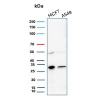CD99 Antibody (MIC2/3478R) Western Blot: CD99 Antibody (MIC2/3478R) [NBP3-07315] -