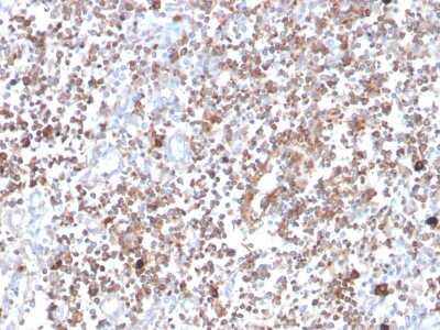 PKC alpha Antibody (133)