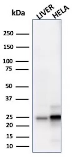 GSTM3 Antibody (CPTC-GSTMu3-1) Western Blot: GSTM3 Antibody (CPTC-GSTMu3-1) [NBP3-07347] -